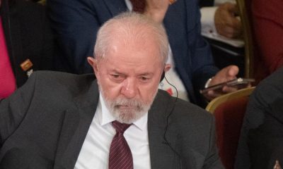 Lula Da Silva es operado de emergencia por hemorragia intracraneal tras caída